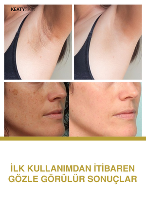 Cam Cilt Etkisi Bakım Seti