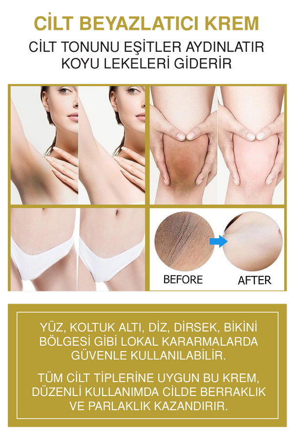 Cilt Beyazlatıcı Set | Peeling 100ml + Beyazlatıcı Krem 50ml